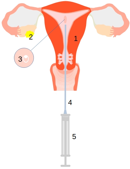 transfer-embrya.jpg, 56kB
