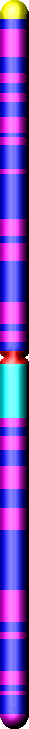 Chromozom 1 s mutací genu MTHFR